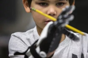 The Helping Hand Project: Prosthetic Devices